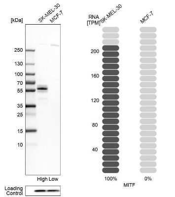 Western Blot: MITF Antibody [NBP1-88618]