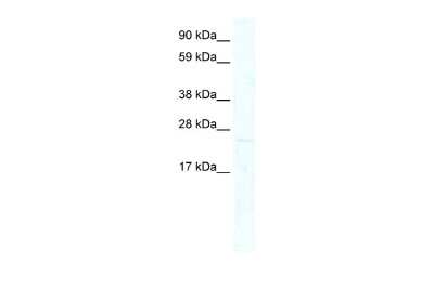 Western Blot: MIXL1 Antibody [NBP2-87808]