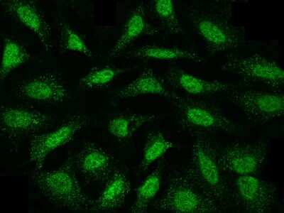 Immunocytochemistry/ Immunofluorescence: MKK4/MEK4 Antibody [NBP2-99331]