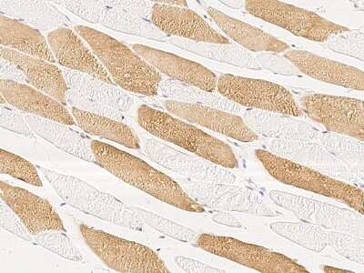 Immunohistochemistry-Paraffin: MKK4/MEK4 Antibody [NBP2-99331]