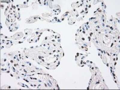 Immunohistochemistry: MKK4/MEK4 Antibody (OTI8A8) - Azide and BSA Free [NBP2-72710]