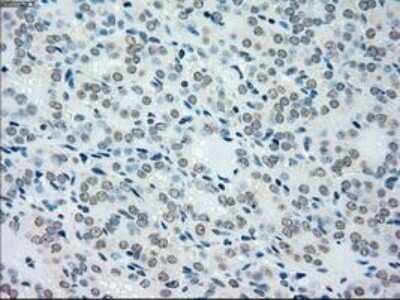 Immunohistochemistry: MKK4/MEK4 Antibody (OTI8A8) - Azide and BSA Free [NBP2-72710]