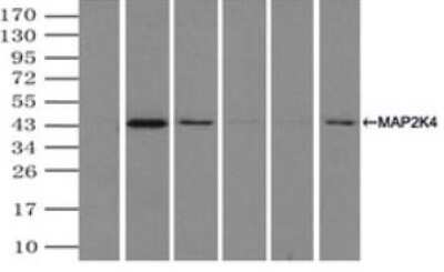 Immunoprecipitation: MKK4/MEK4 Antibody (OTI8A8) - Azide and BSA Free [NBP2-72710]