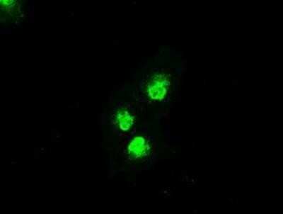 Immunocytochemistry/ Immunofluorescence: MKK4/MEK4 Antibody (OTI8A8) [NBP1-47839]