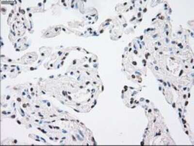Immunohistochemistry-Paraffin: MKK4/MEK4 Antibody (OTI8A8) [NBP1-47839]
