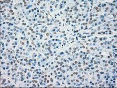 Immunohistochemistry-Paraffin: MKK4/MEK4 Antibody (OTI8A8) [NBP1-47839]