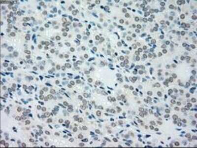 Immunohistochemistry-Paraffin: MKK4/MEK4 Antibody (OTI8A8) [NBP1-47839]