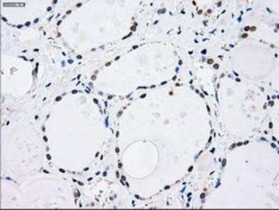 Immunohistochemistry-Paraffin: MKK4/MEK4 Antibody (OTI8A8) [NBP1-47839]