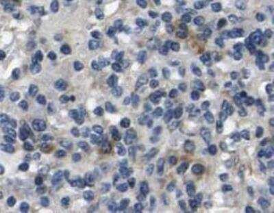 Immunohistochemistry-Paraffin: MKK4/MEK4 Antibody (OTI8A8) [NBP1-47839]