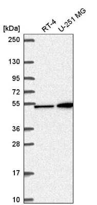 Western Blot: MKK4/MEK4 Antibody [NBP2-57194]