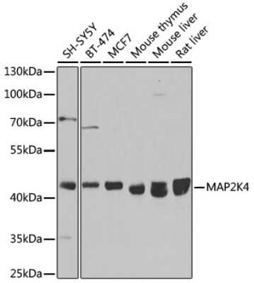 Western Blot: MKK4/MEK4 AntibodyBSA Free [NBP3-03652]