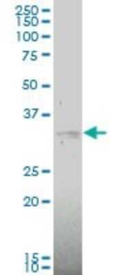 Western Blot: MKK6/MEK6 Antibody (2F2) [H00005608-M02]