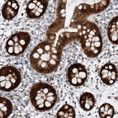 Immunohistochemistry-Paraffin: MKK6/MEK6 Antibody [NBP1-87791]
