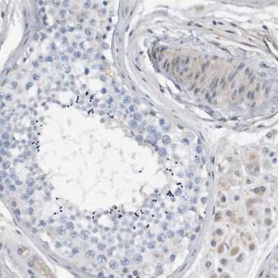 Immunohistochemistry-Paraffin: MKK6/MEK6 Antibody [NBP1-87791]