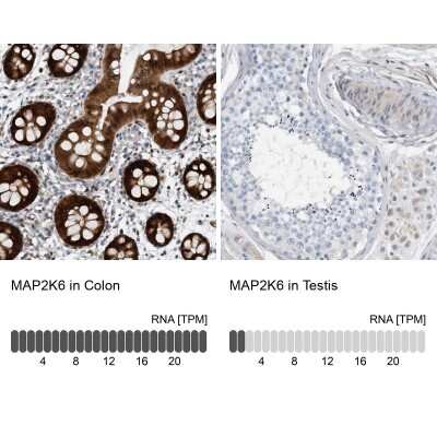 Immunohistochemistry-Paraffin: MKK6/MEK6 Antibody [NBP1-87791]