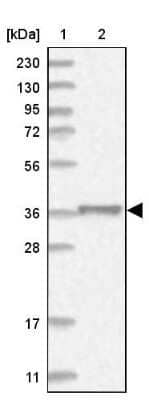 Western Blot: MKK6/MEK6 Antibody [NBP1-87791]