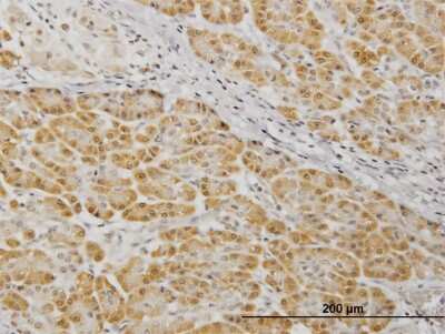 Immunohistochemistry-Paraffin: MKK7/MEK7 Antibody (2G5) [H00005609-M04]