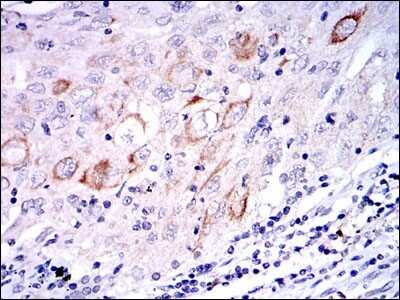 Immunohistochemistry: MKK7/MEK7 Antibody (4E5) - BSA Free [NBP2-37542]