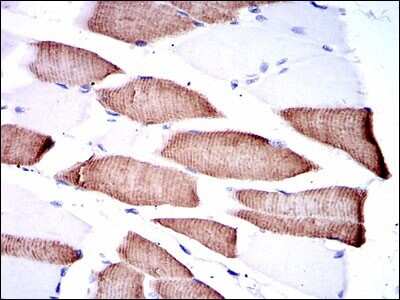 Immunohistochemistry: MKK7/MEK7 Antibody (4E5) - BSA Free [NBP2-37542]