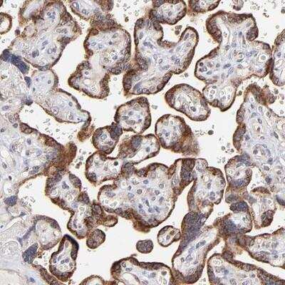 Immunohistochemistry: MKK7/MEK7 Antibody [NBP1-87792]