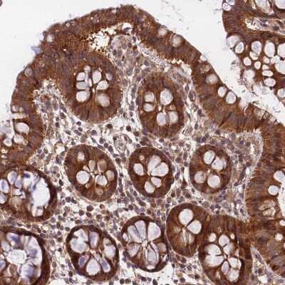 Immunohistochemistry-Paraffin: MKKS Antibody [NBP1-92122]