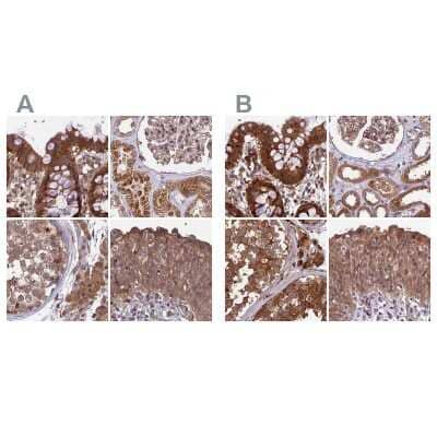 Immunohistochemistry-Paraffin: MKKS Antibody [NBP1-92122]