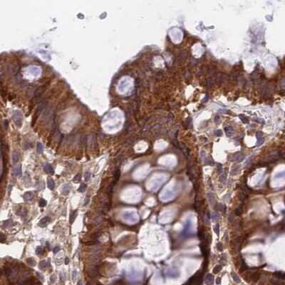 Immunohistochemistry-Paraffin: MKKS Antibody [NBP1-92122]