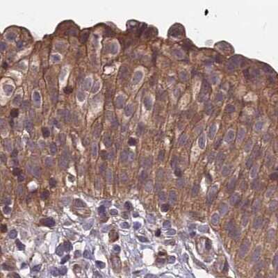 Immunohistochemistry-Paraffin: MKKS Antibody [NBP1-92122]