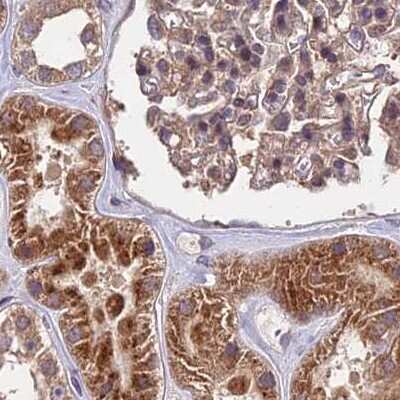 Immunohistochemistry-Paraffin: MKKS Antibody [NBP1-92122]