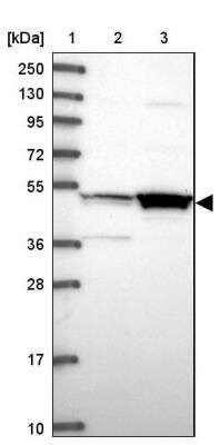 Western Blot: MKKS Antibody [NBP1-92123]