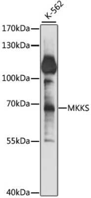 Western Blot: MKKS AntibodyAzide and BSA Free [NBP3-04866]