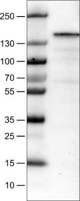 Western Blot: MKL2 Antibody (CL1546) [NBP2-52970]