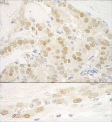 Immunohistochemistry-Paraffin: MKL2 Antibody [NBP1-46209]