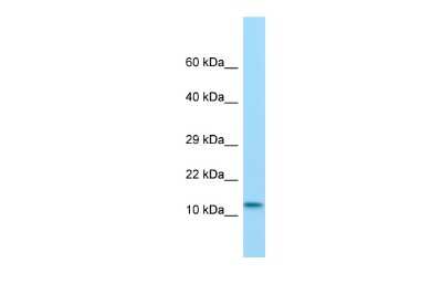 Western Blot: MKL2 Antibody [NBP3-09279]