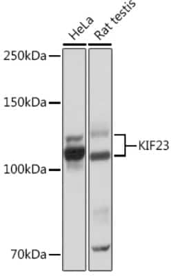 Western Blot: MKLP1 Antibody (9V4Y8) [NBP3-16507]