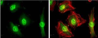 Immunocytochemistry/ Immunofluorescence: MKLP1 Antibody [NBP2-17299]