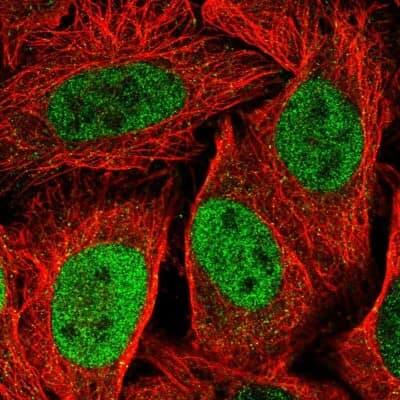 Immunocytochemistry/ Immunofluorescence: MKLP1 Antibody [NBP2-55279]