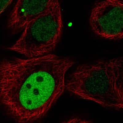 Immunocytochemistry/ Immunofluorescence: MKLP1 Antibody [NBP2-56923]