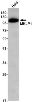 Western Blot: MKLP1 Antibody (S07-2H3) [NBP3-19692]