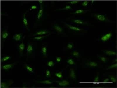 Immunocytochemistry/ Immunofluorescence: MKP-1/DUSP1 Antibody (3A9) [H00001843-M05]