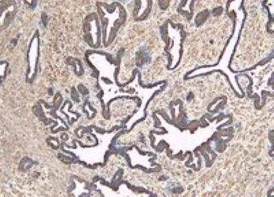 Immunohistochemistry-Paraffin: MKP-1/DUSP1 Antibody [NB100-834]
