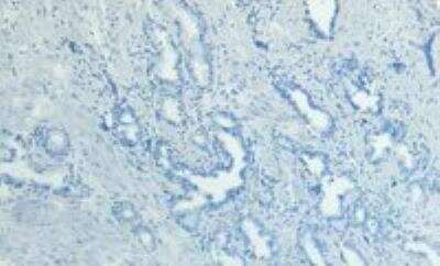 Immunohistochemistry-Paraffin: MKP-1/DUSP1 Antibody [NB100-834]