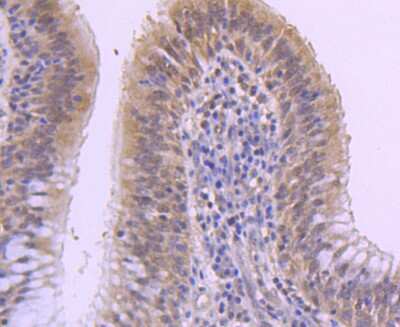 Immunohistochemistry-Paraffin: MKP-1/DUSP1 Antibody (JJ0930) [NBP2-67909]