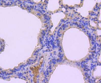 Immunohistochemistry-Paraffin: MKP-1/DUSP1 Antibody (JJ0930) [NBP2-67909]