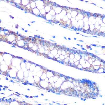 Immunohistochemistry-Paraffin: MKP-3/DUSP6 Antibody (1V5L10) [NBP3-15252]