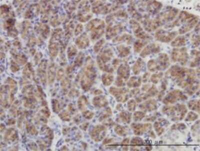 Immunohistochemistry-Paraffin: MKP-3/DUSP6 Antibody (3G2) [H00001848-M01]