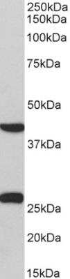 Western Blot: MKP-3/DUSP6 Antibody [NBP2-26174]