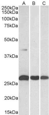 Western Blot: MKP-3/DUSP6 Antibody [NBP2-26174]