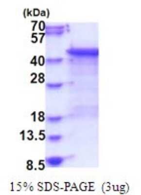 SDS-PAGE: Recombinant Human MKP-3/DUSP6 His Protein [NBP2-51786]