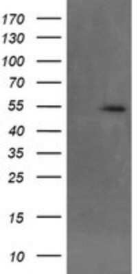 Western Blot: MKRN1 Antibody (OTI2C8)Azide and BSA Free [NBP2-72718]